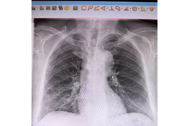 ЧР Сывлӑх сыхлав министерствин сӑнӳкерчӗкӗ